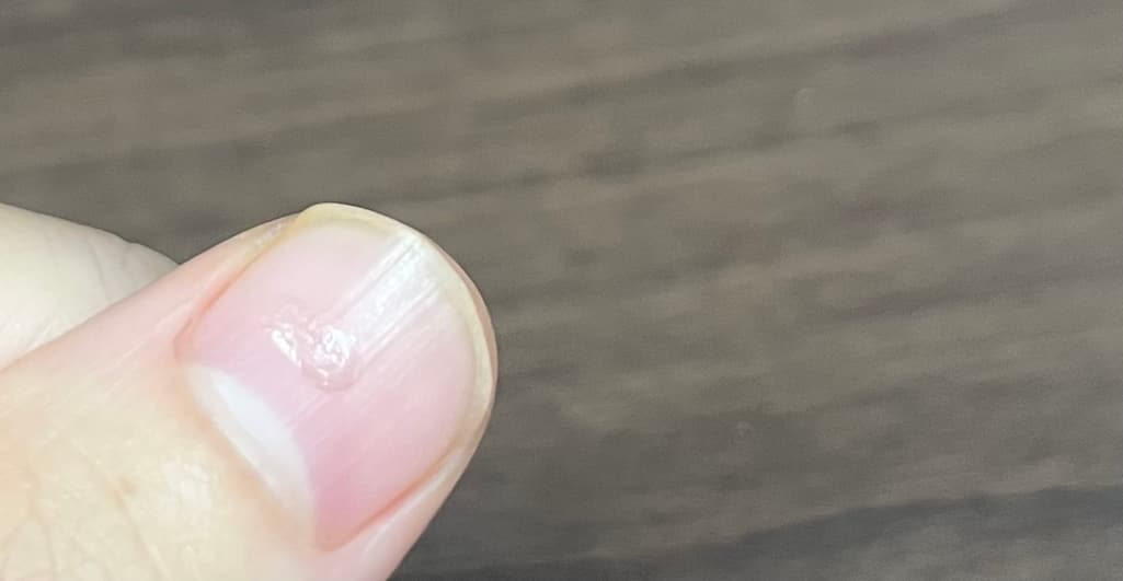 2번 째 사진