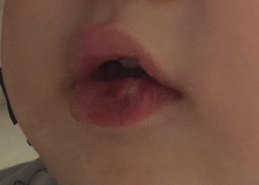 2번 째 사진