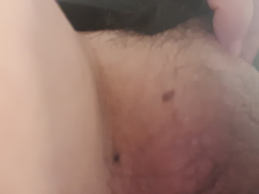 2번 째 사진