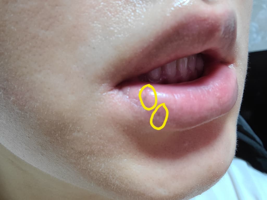 2번 째 사진