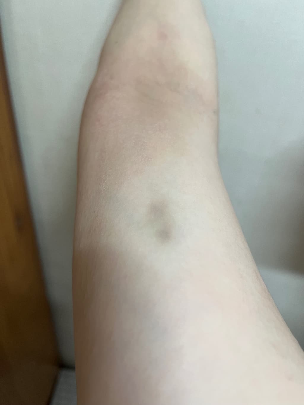 2번 째 사진