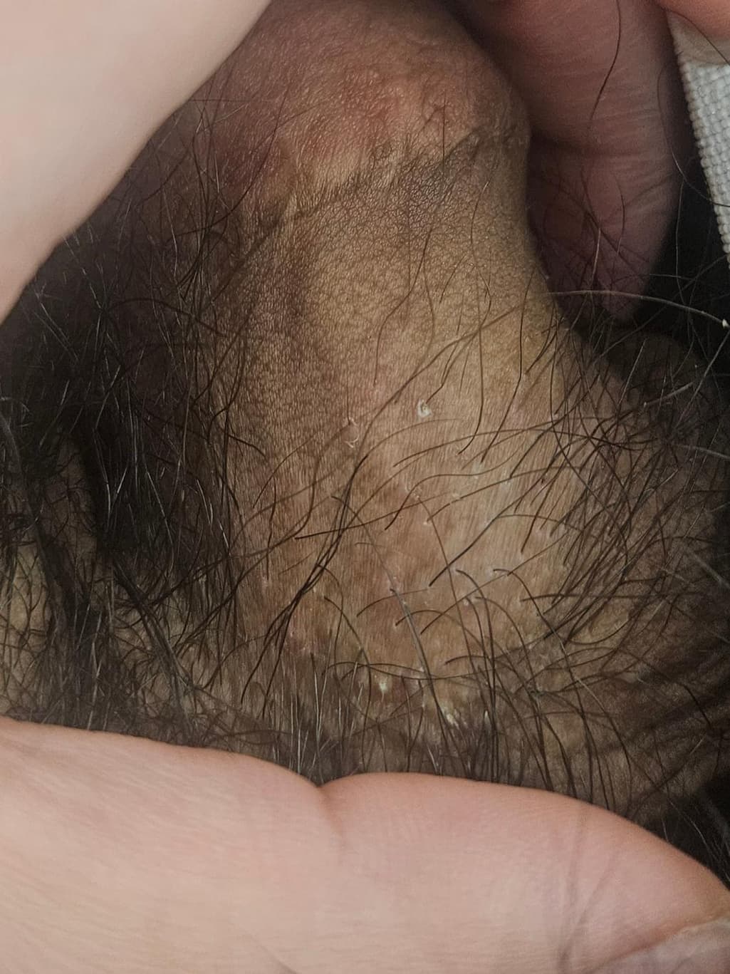 2번 째 사진