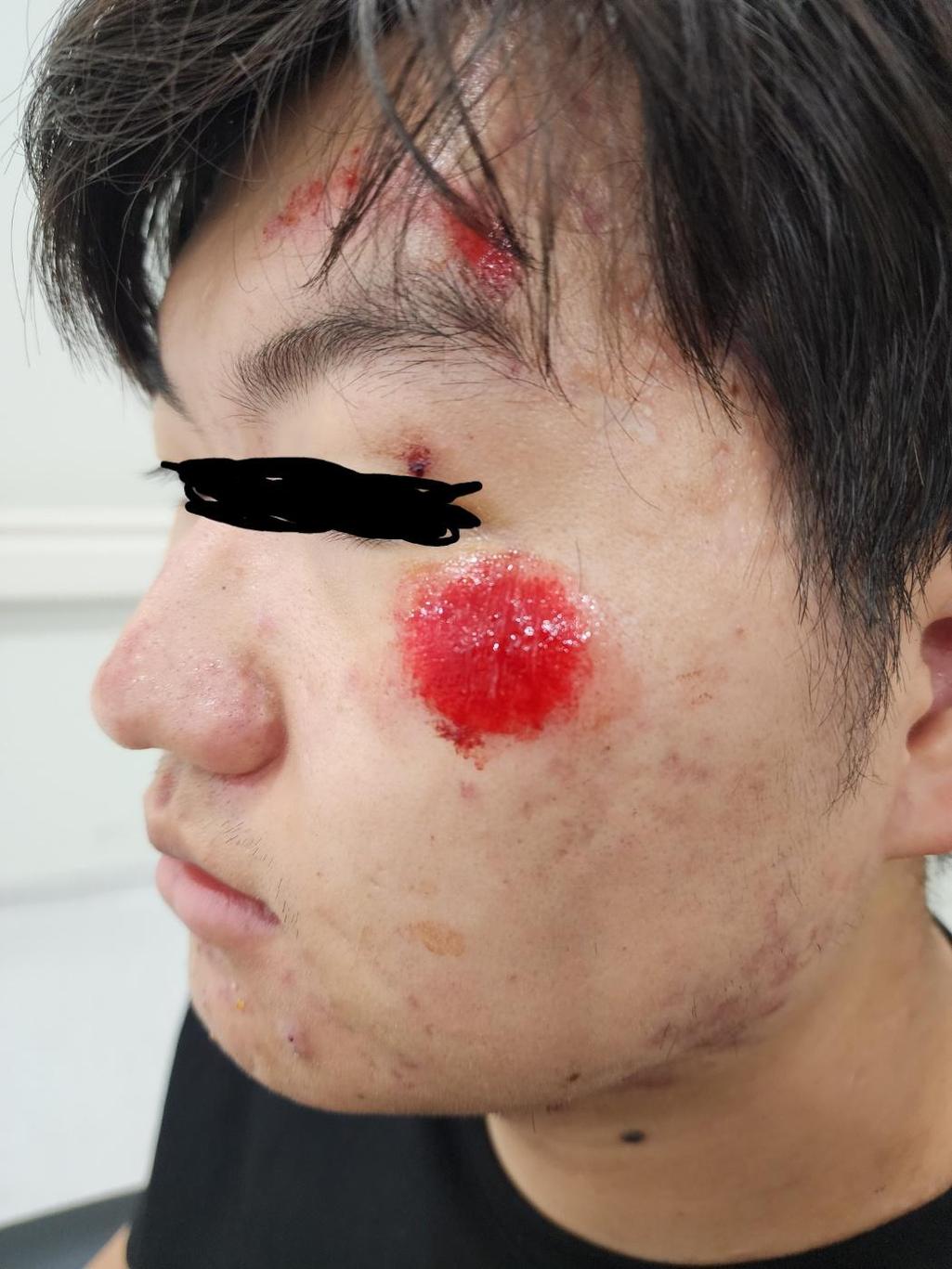 1번 째 사진