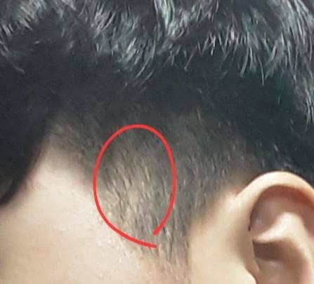 2번 째 사진