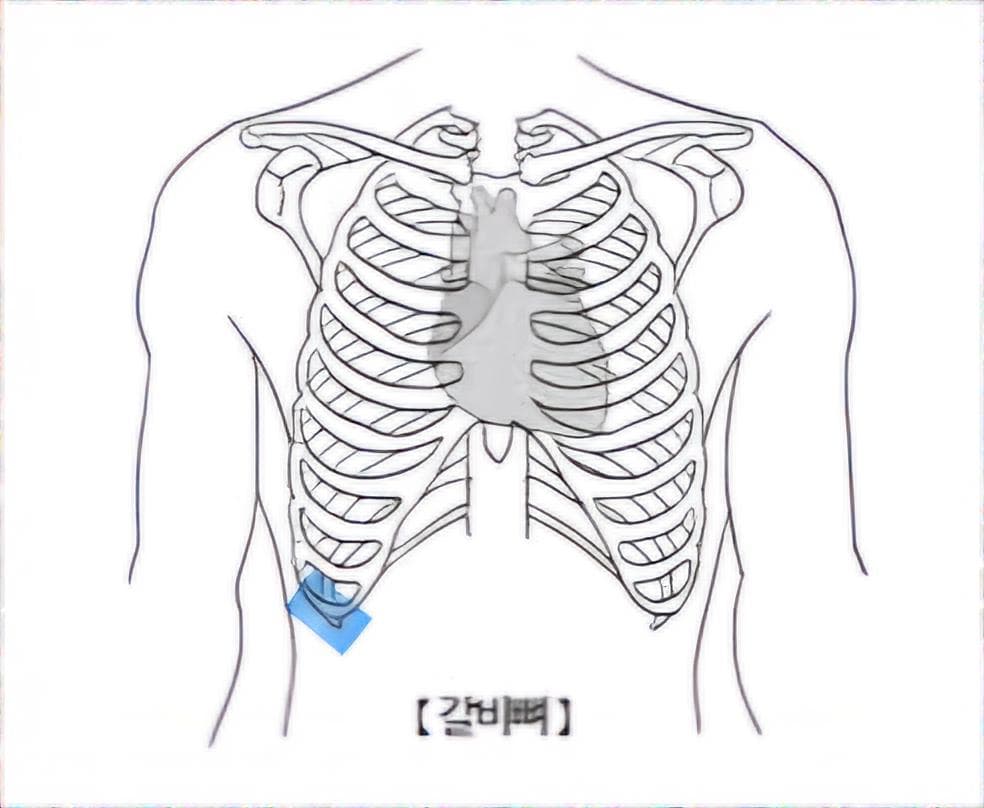 2번 째 사진