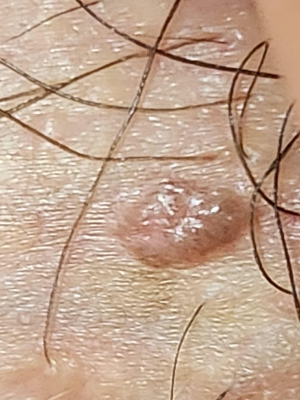 4번 째 사진