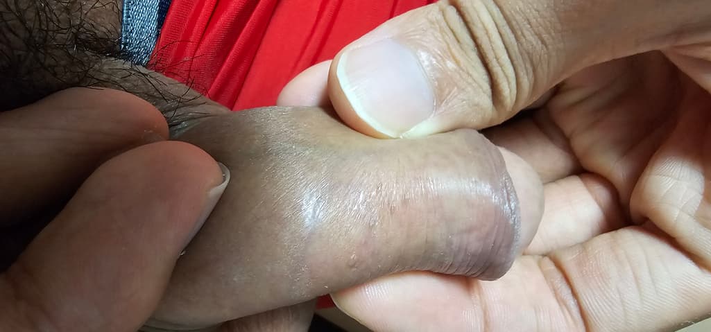 2번 째 사진