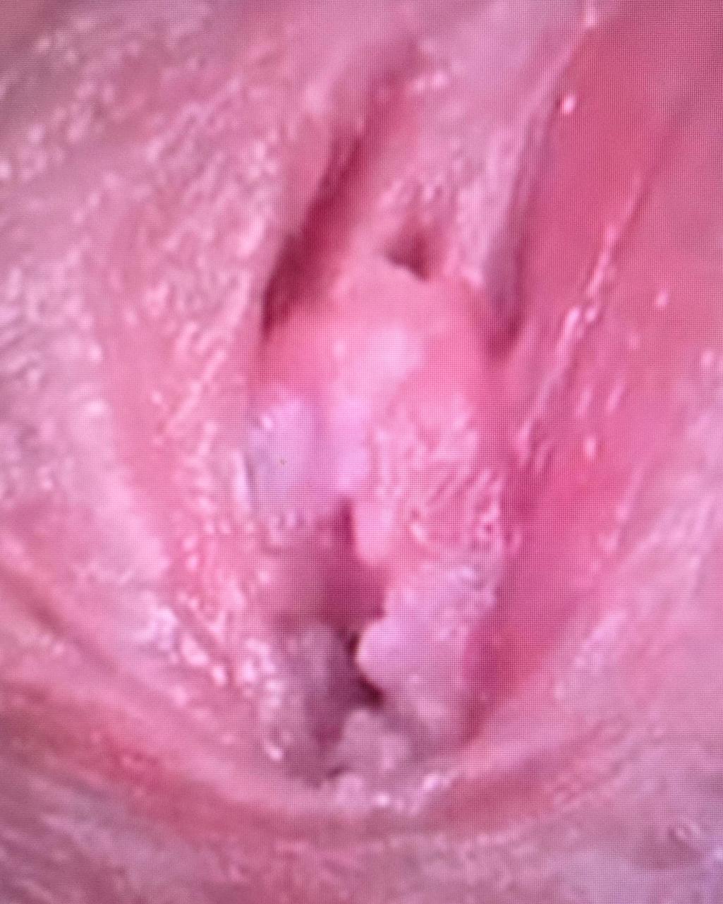 8번 째 사진