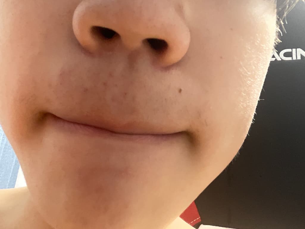 2번 째 사진