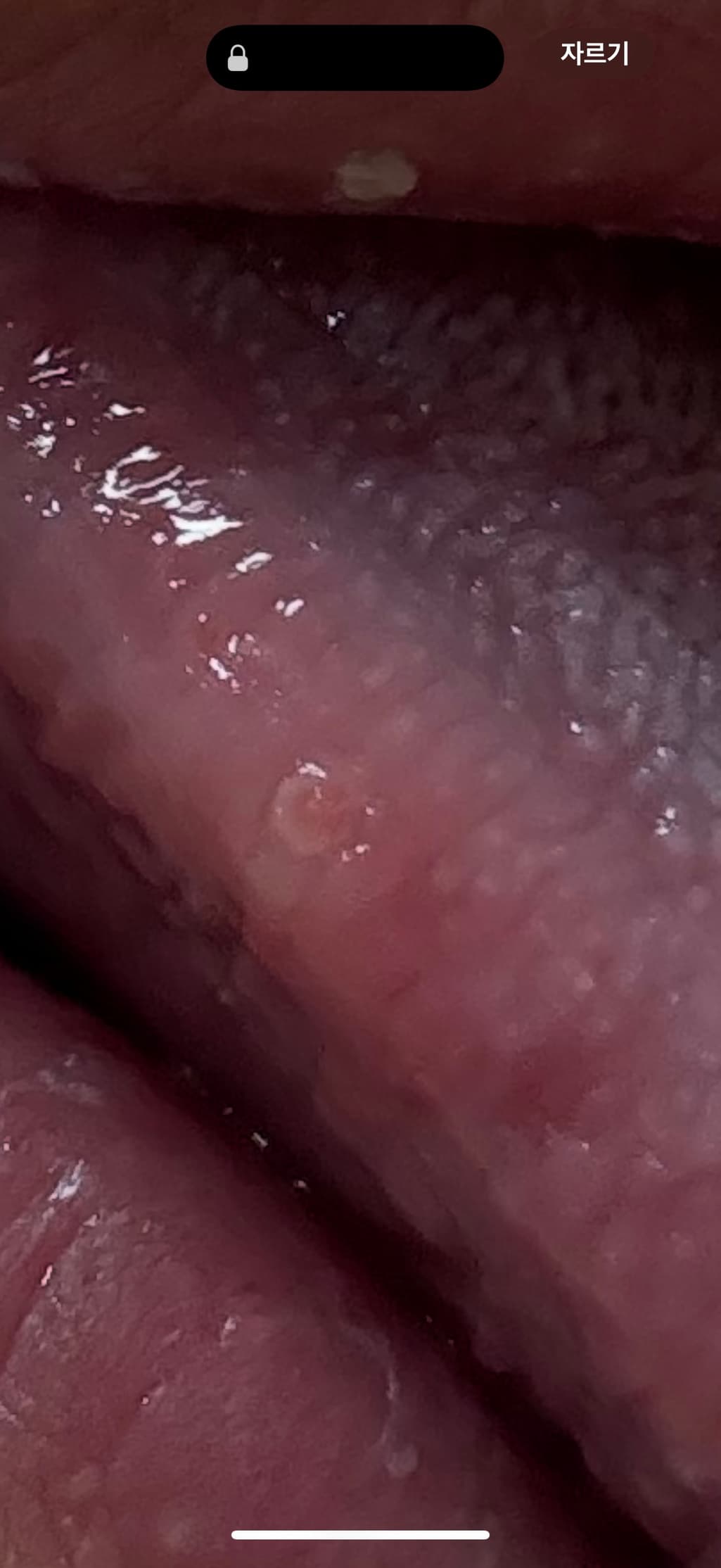 3번 째 사진