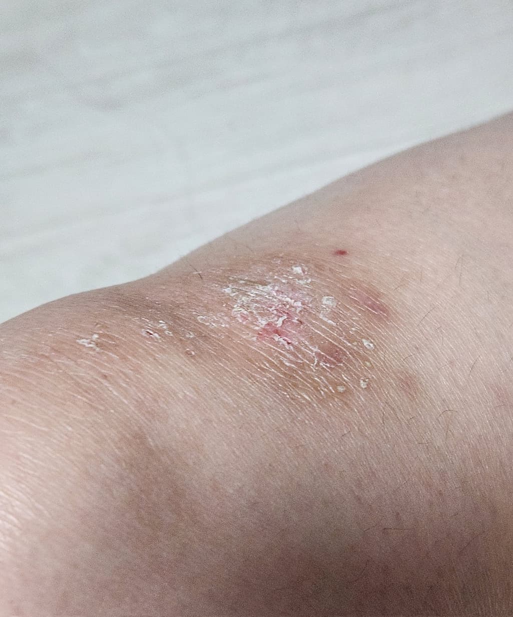 2번 째 사진