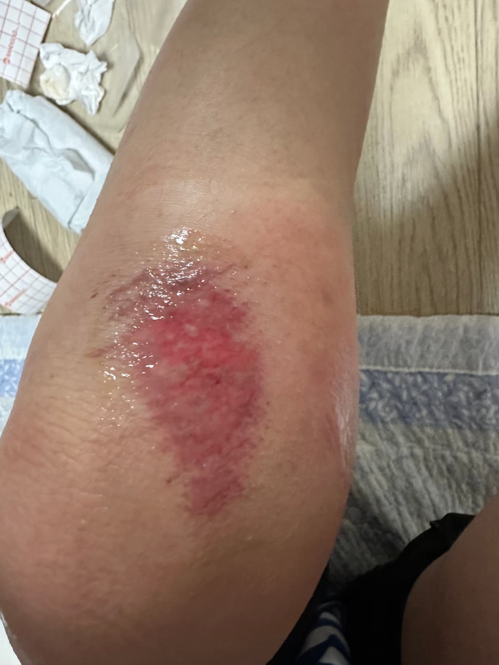 3번 째 사진