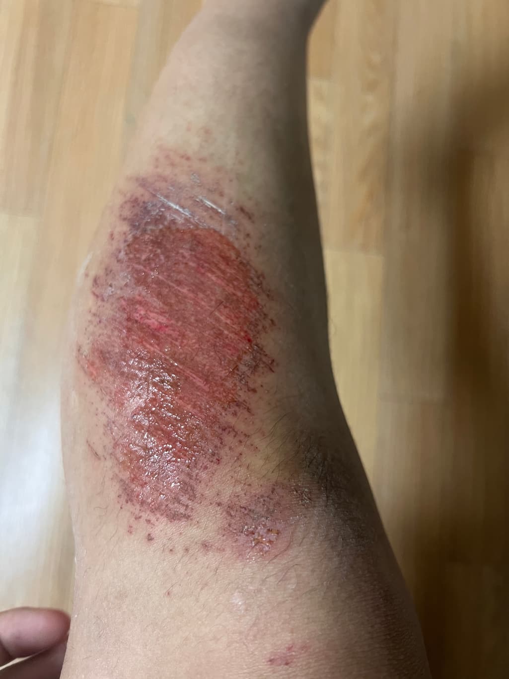 1번 째 사진
