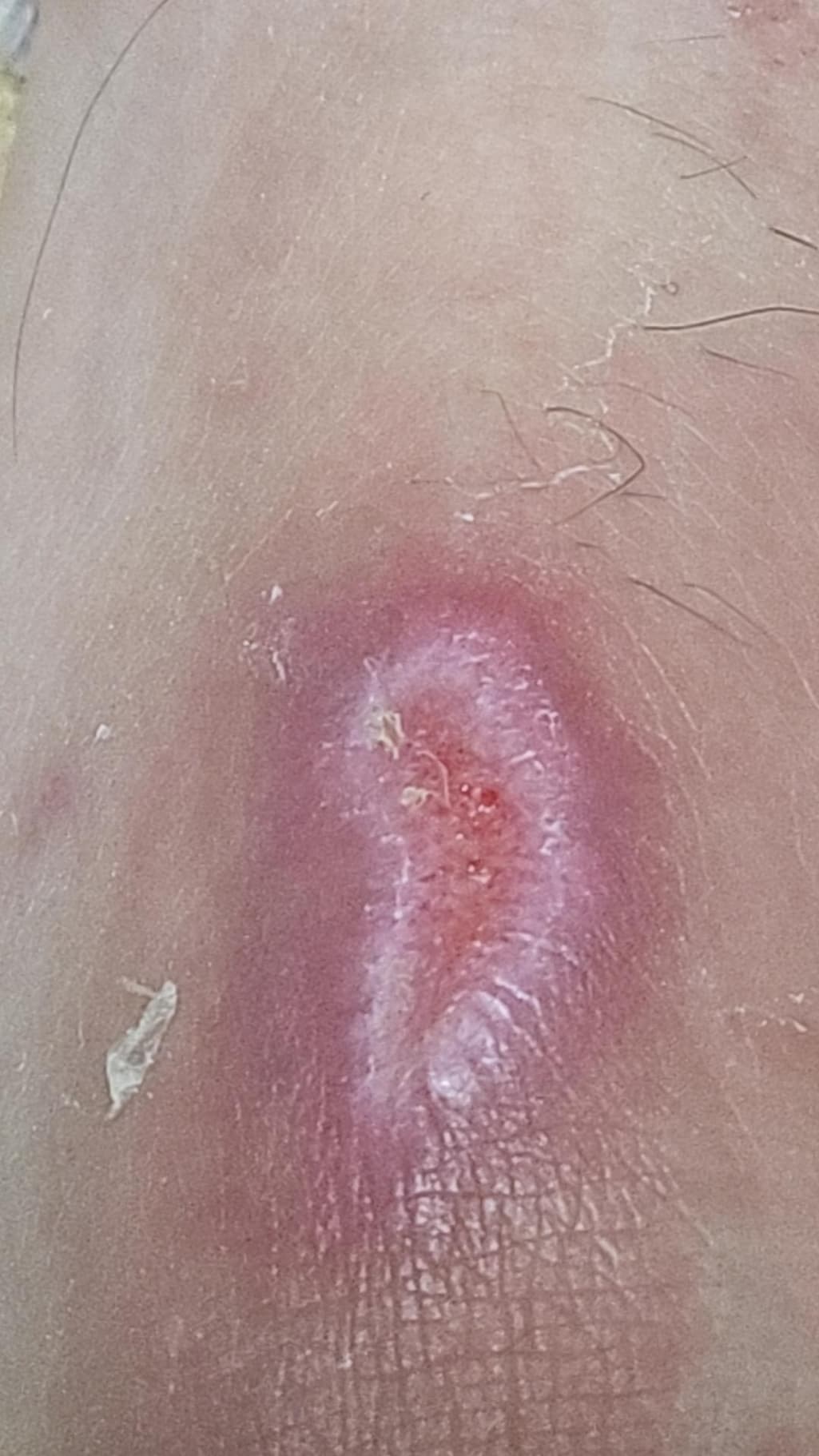 2번 째 사진