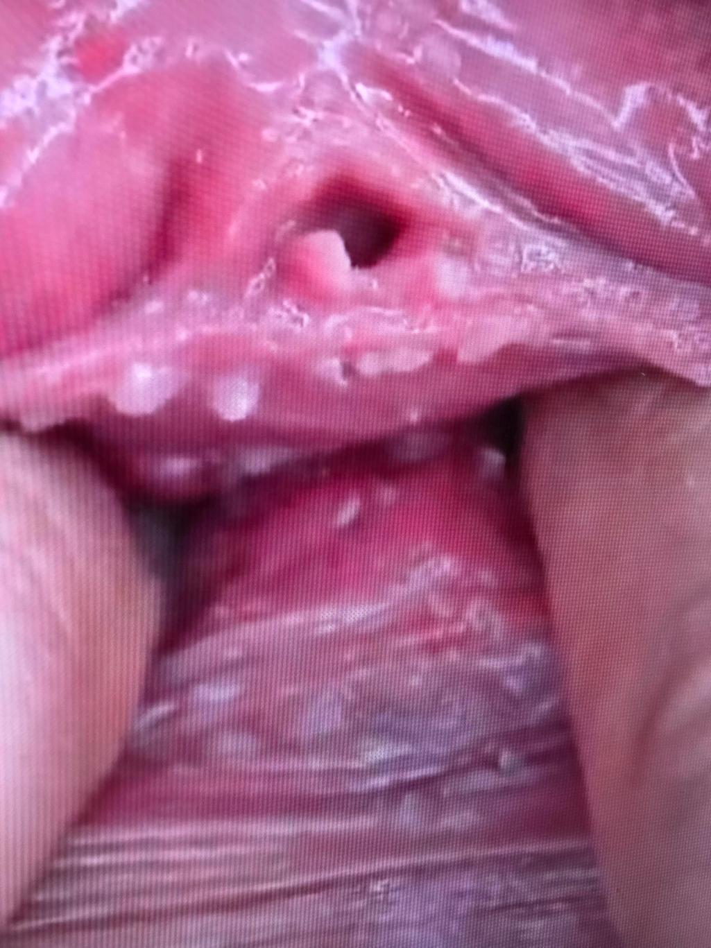 9번 째 사진