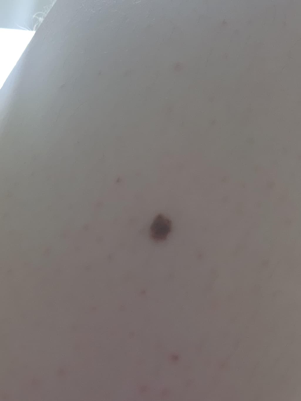 2번 째 사진