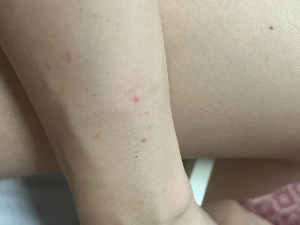 2번 째 사진
