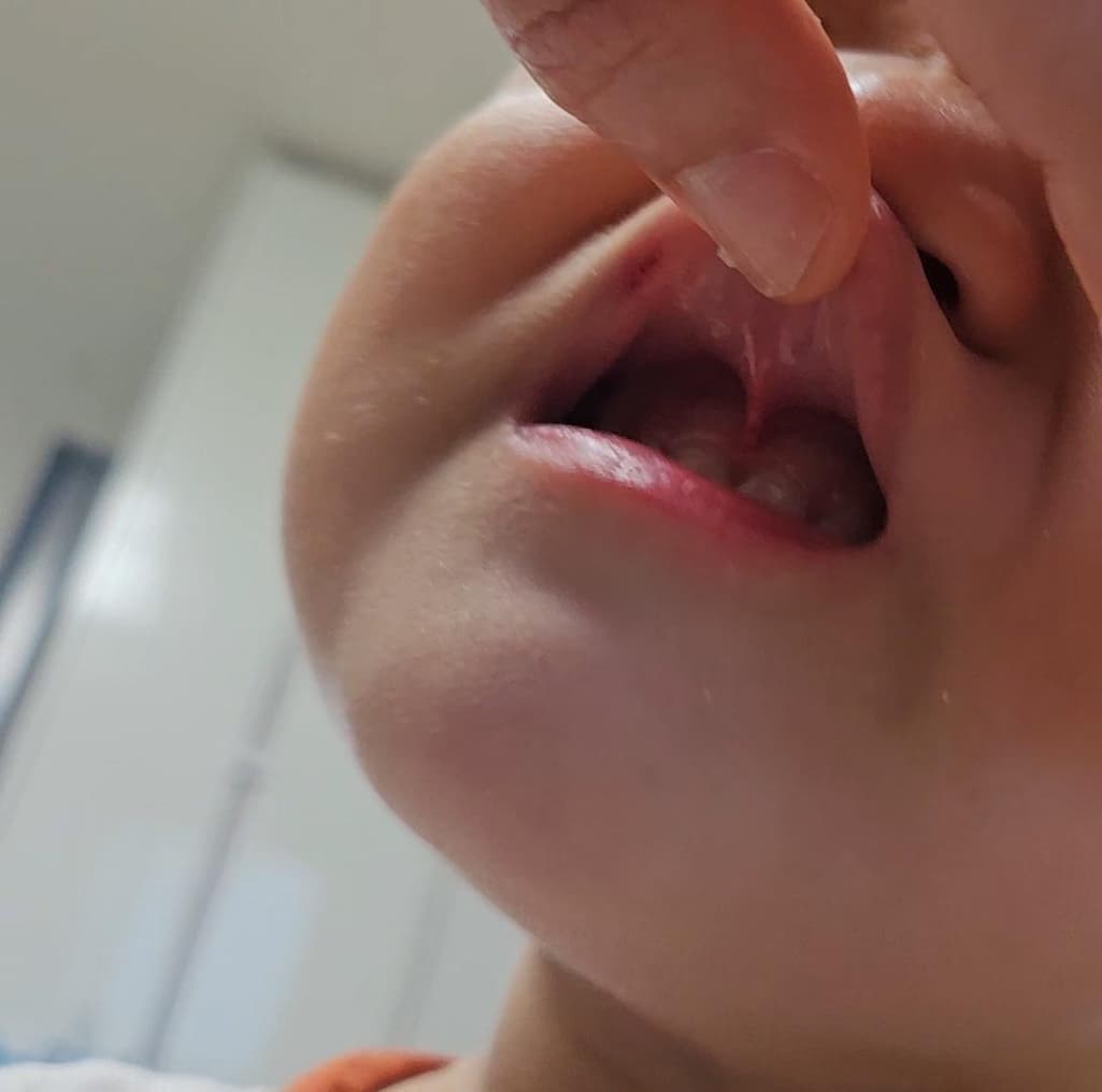 2번 째 사진