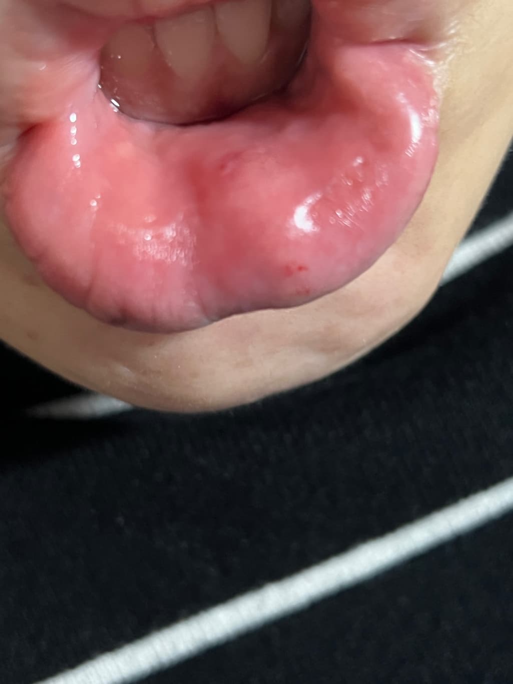 3번 째 사진