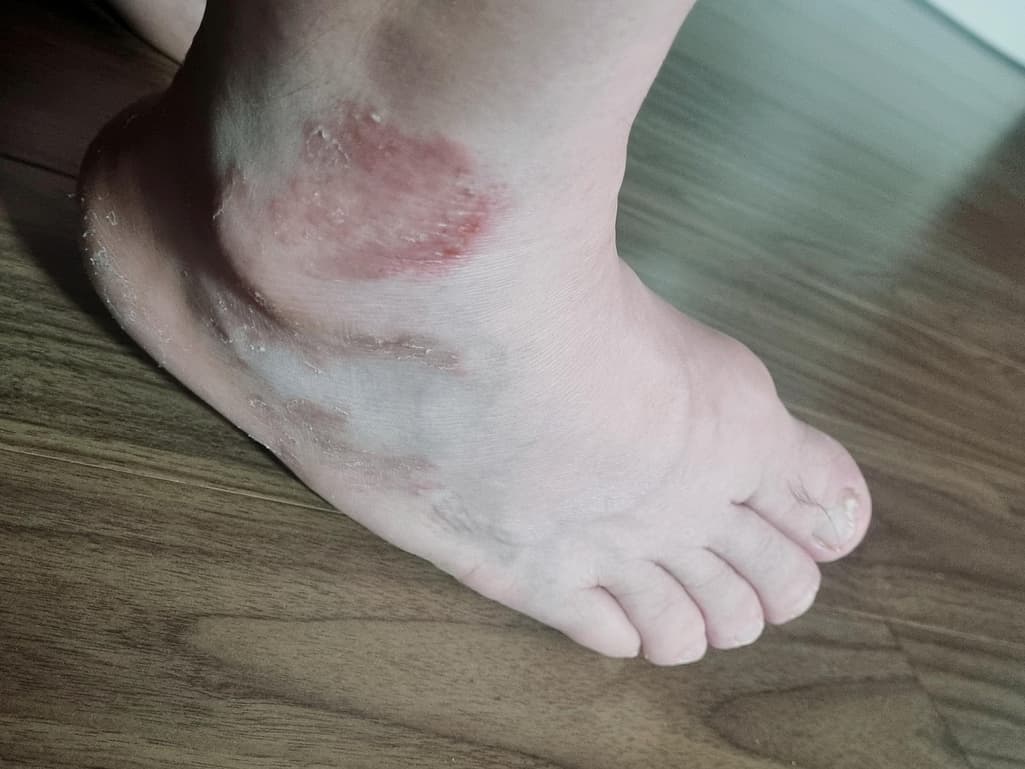 2번 째 사진