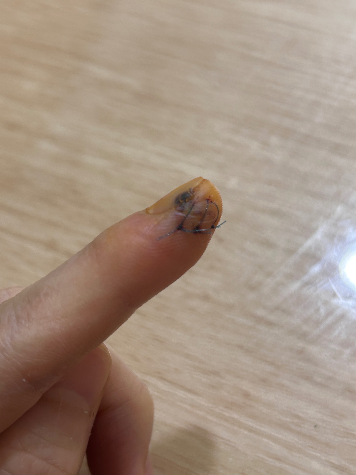 2번 째 사진