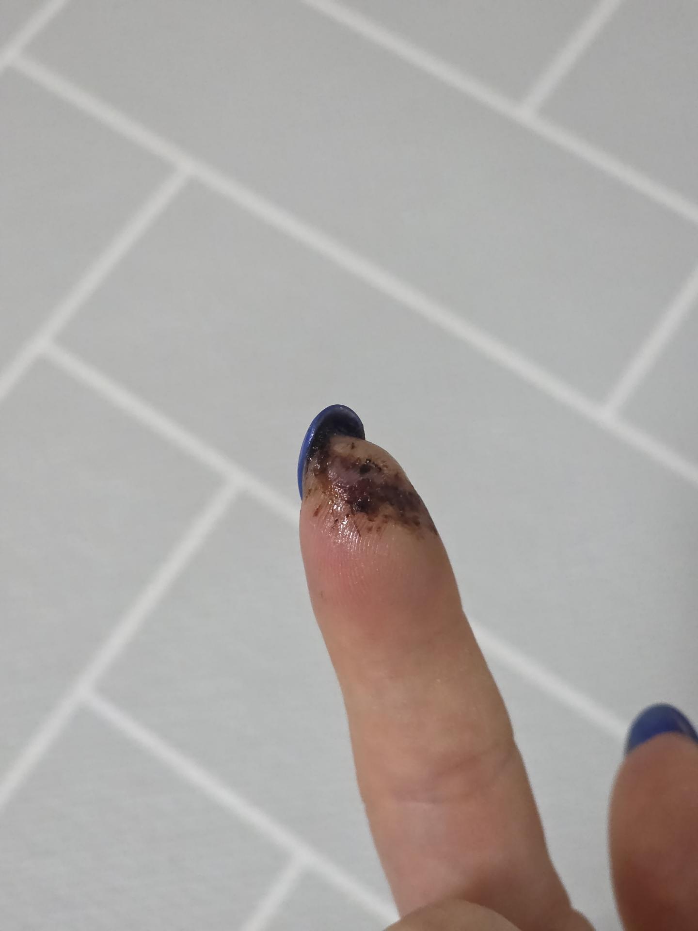 2번 째 사진