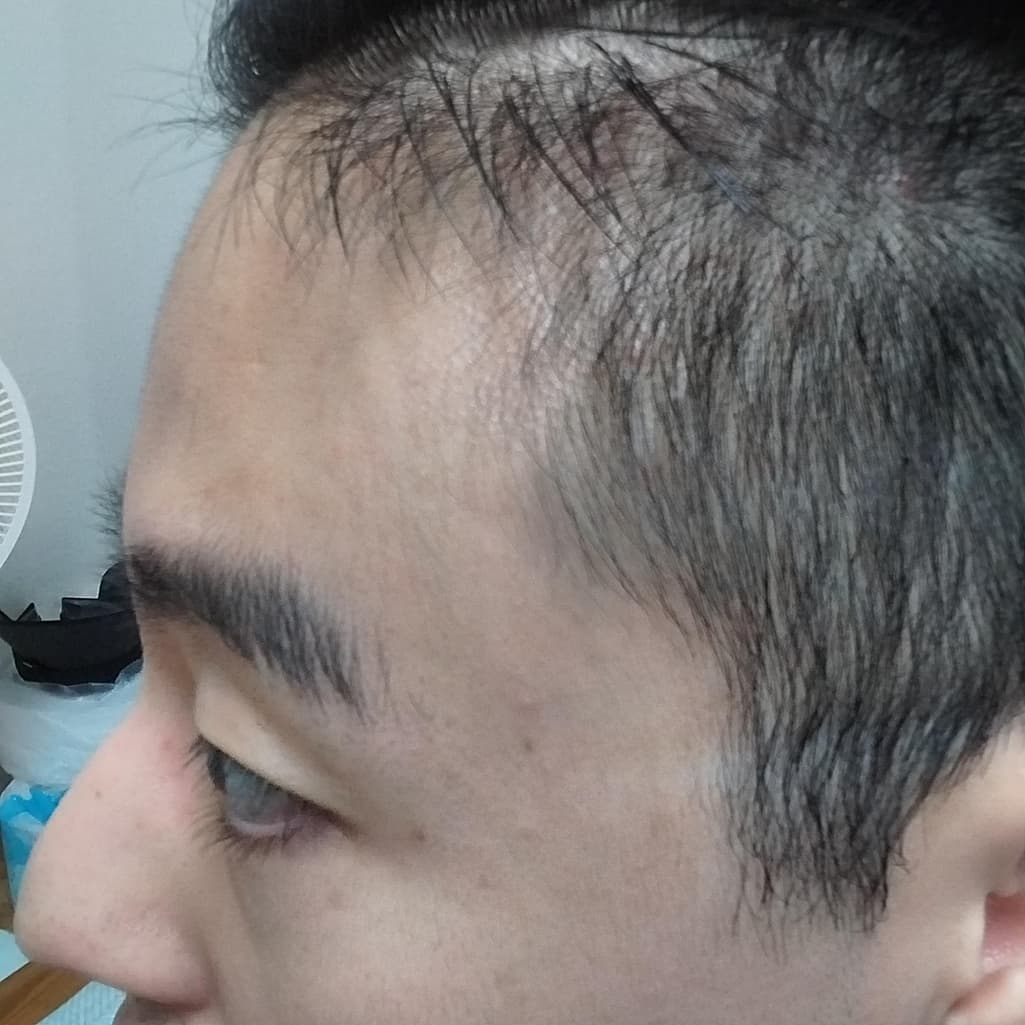 3번 째 사진
