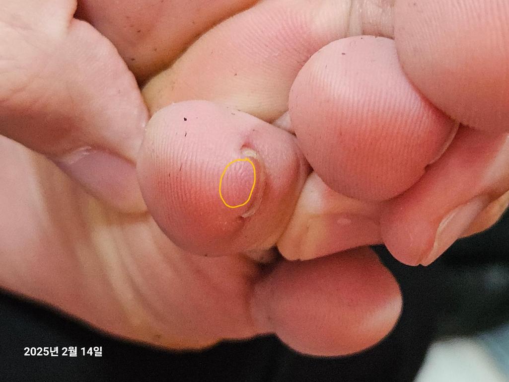 2번 째 사진