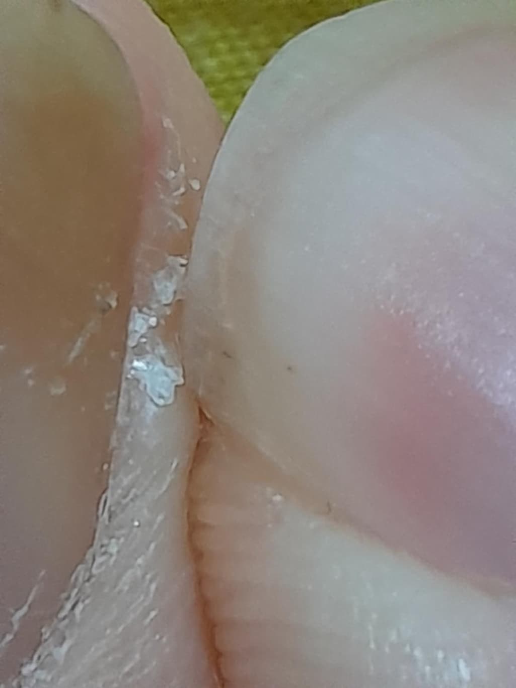 6번 째 사진