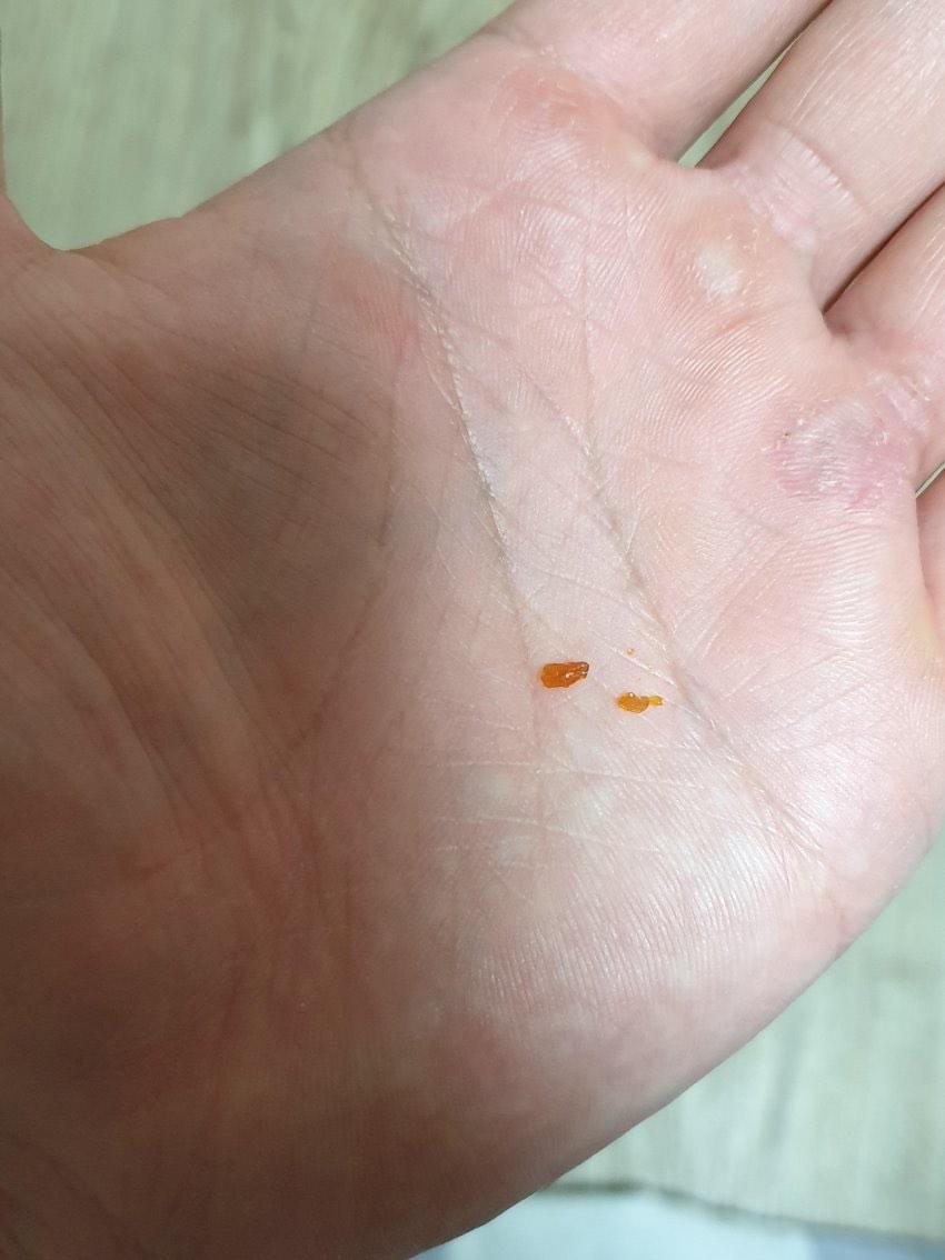 2번 째 사진