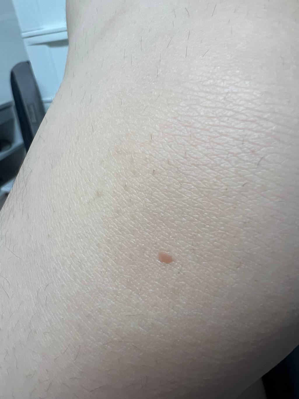 2번 째 사진