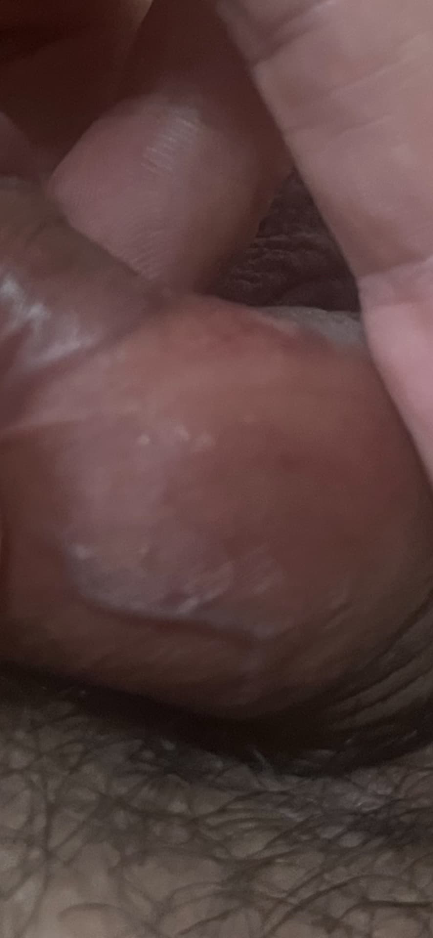 2번 째 사진
