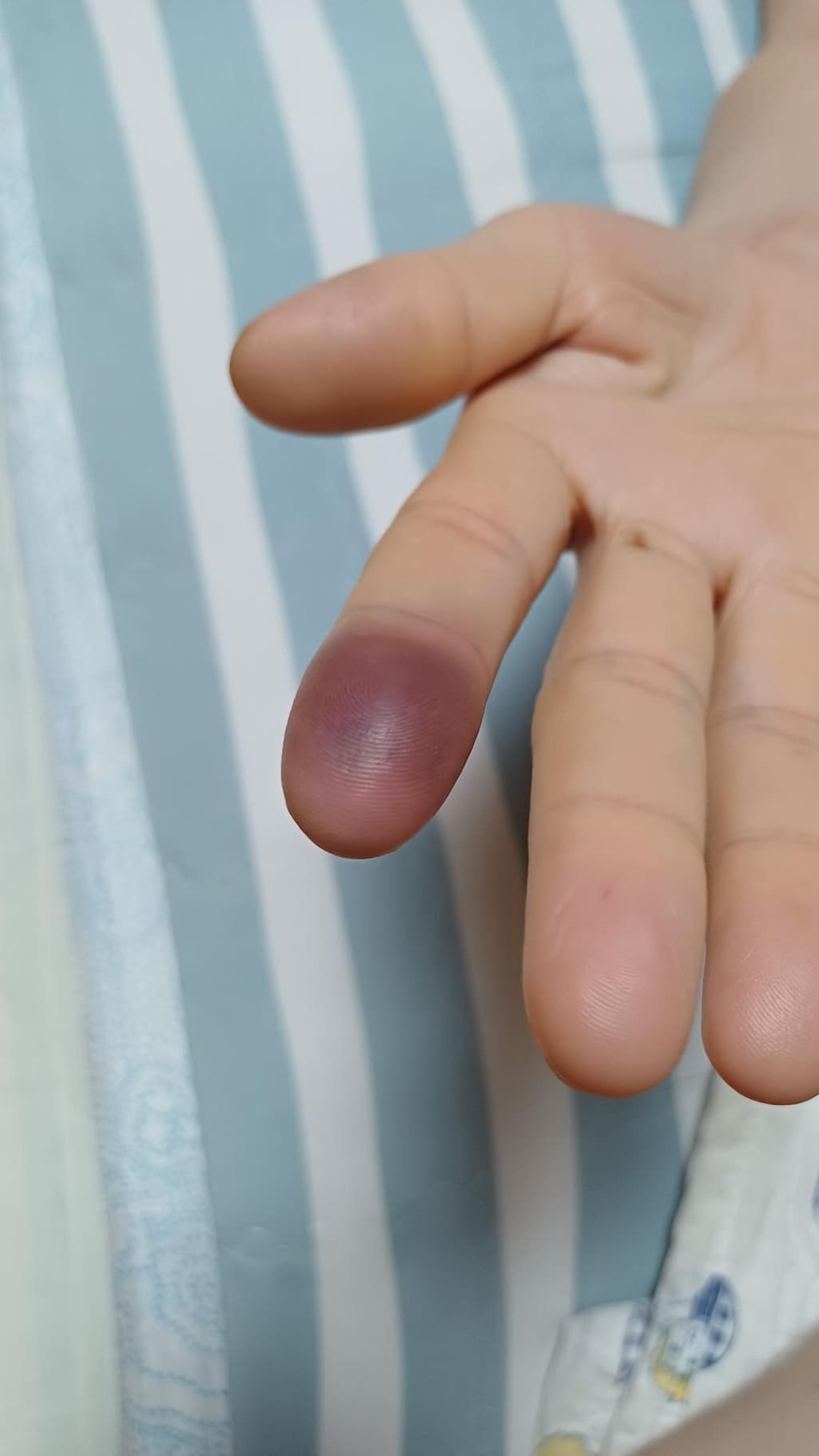 2번 째 사진
