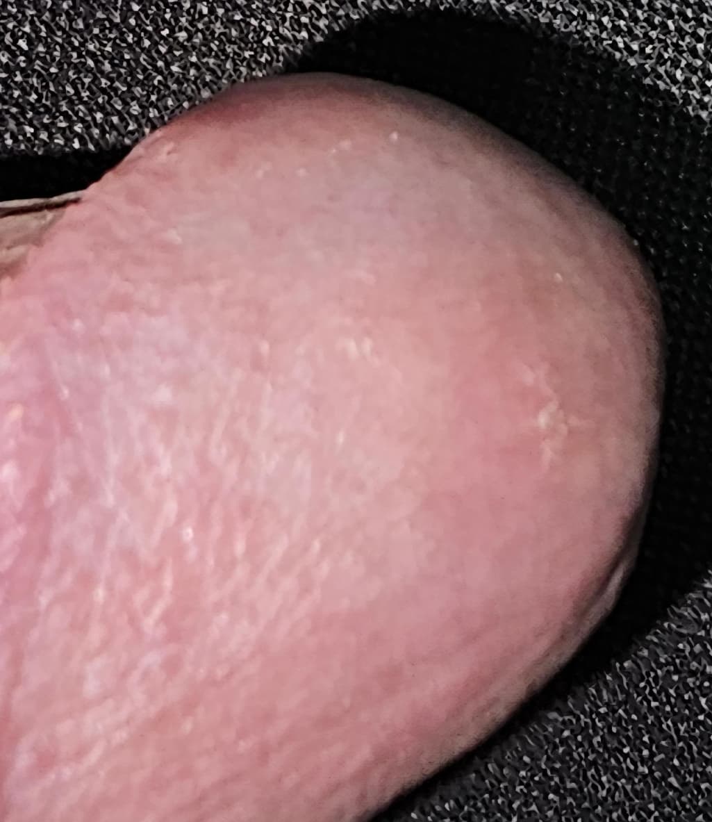3번 째 사진