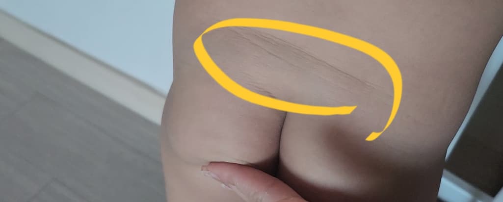 2번 째 사진