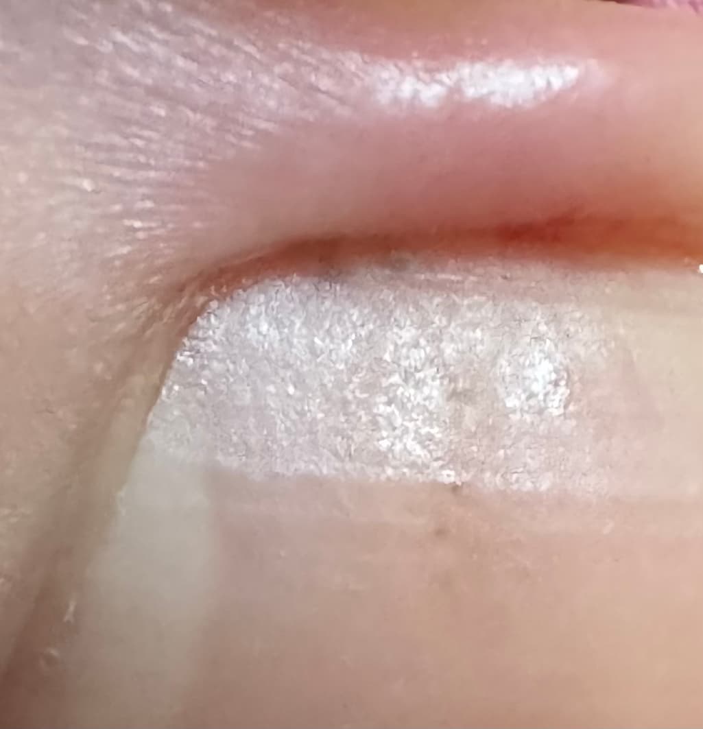 2번 째 사진