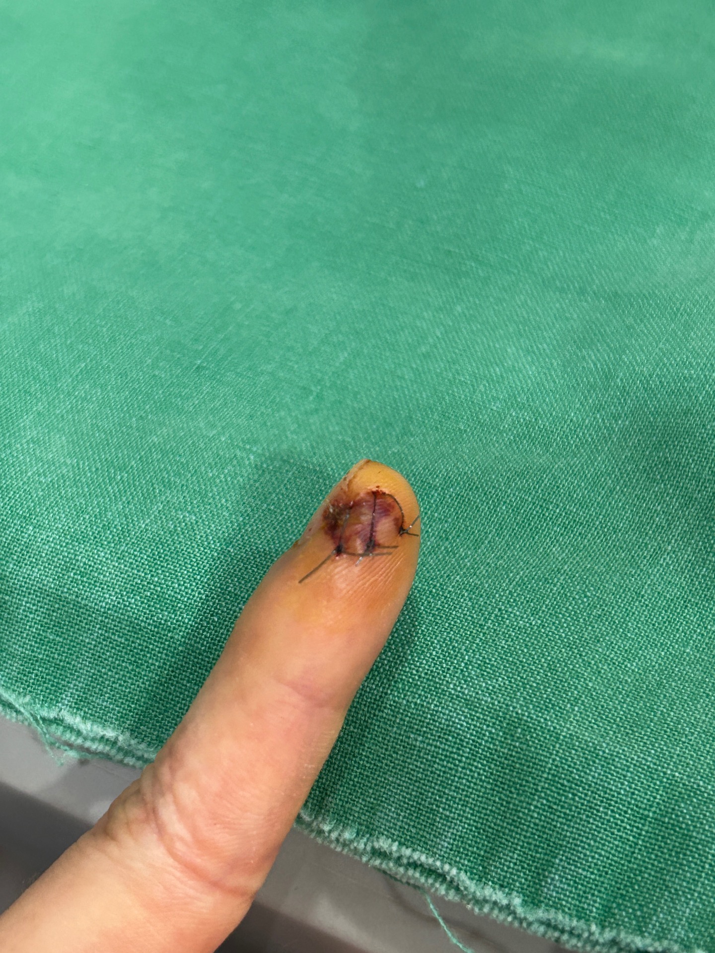1번 째 사진