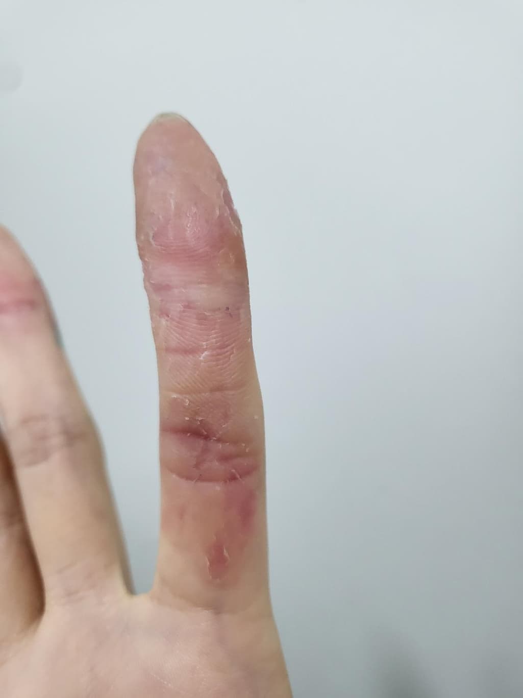 2번 째 사진