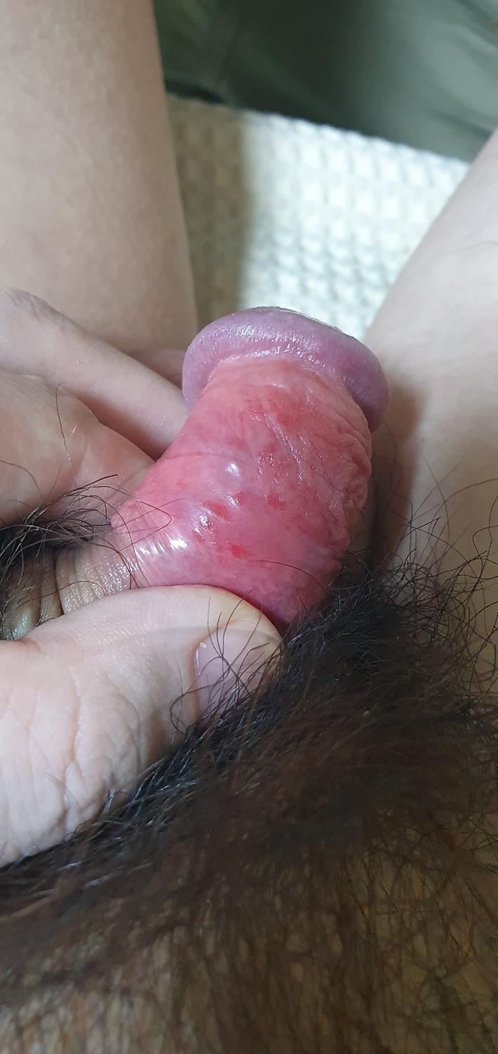 3번 째 사진
