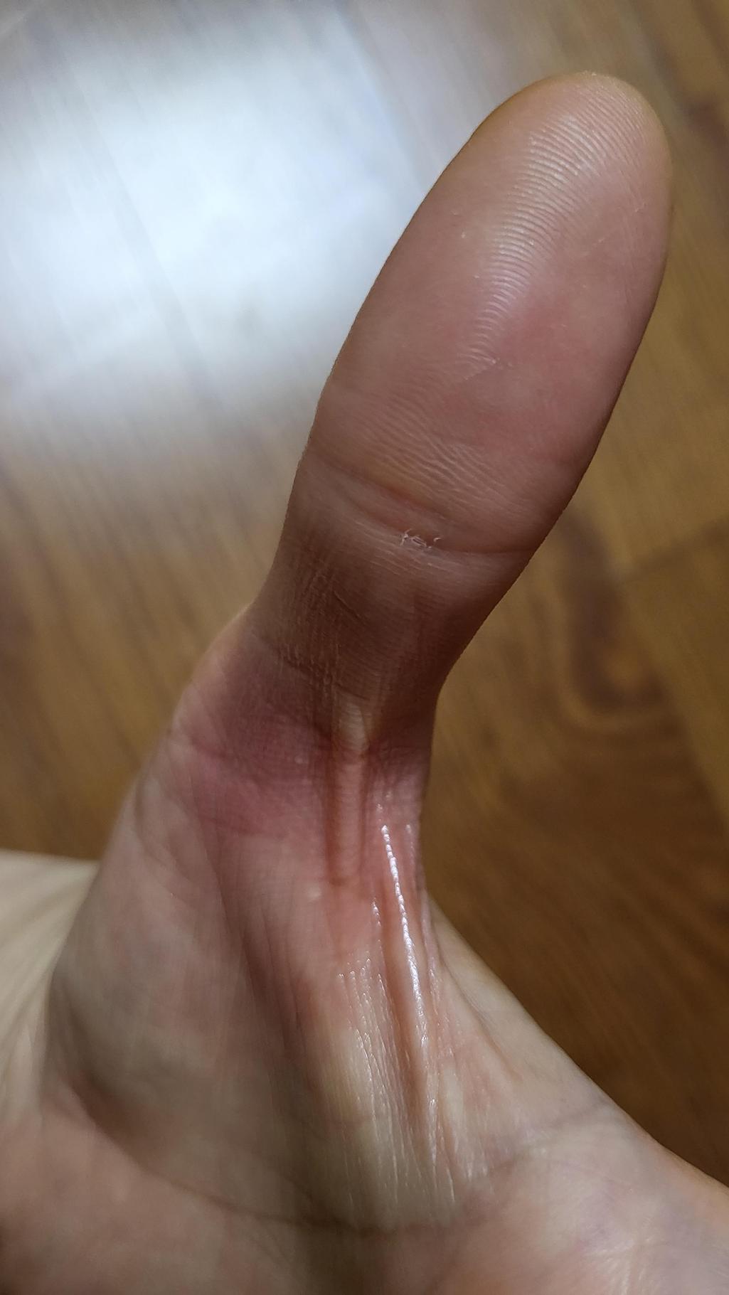 2번 째 사진