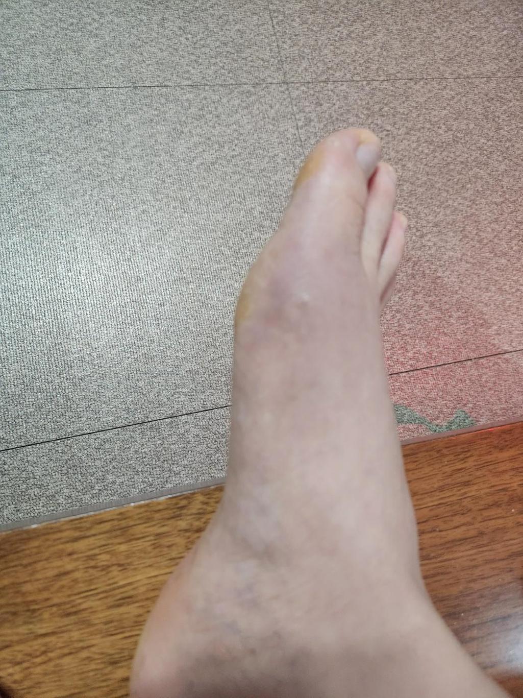 2번 째 사진