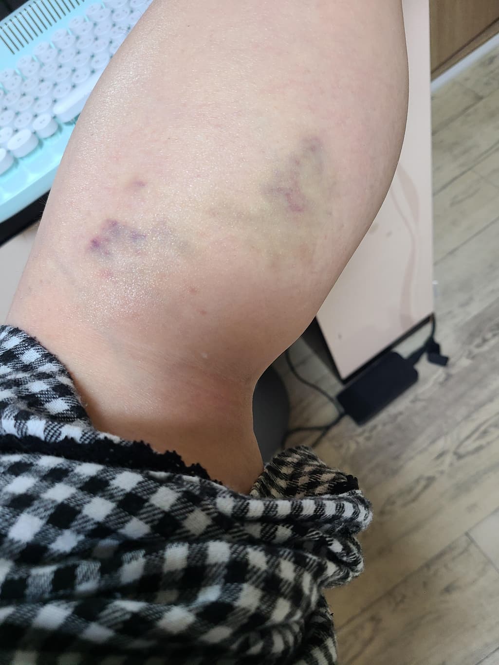 2번 째 사진