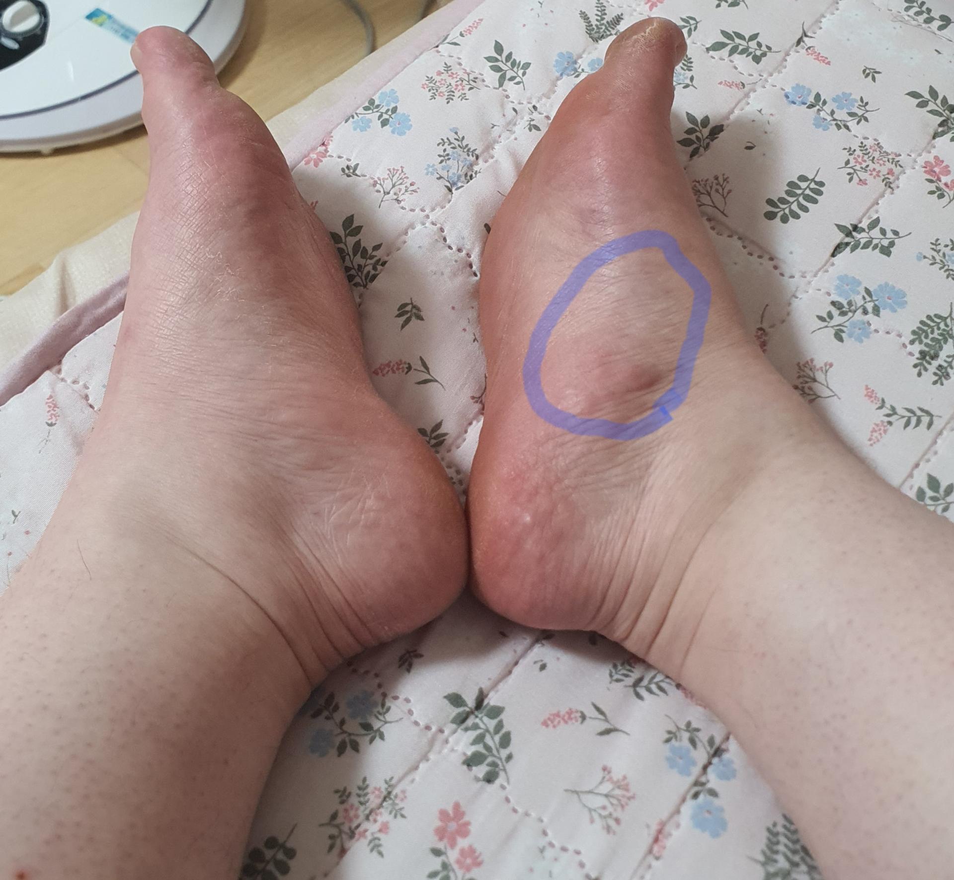2번 째 사진