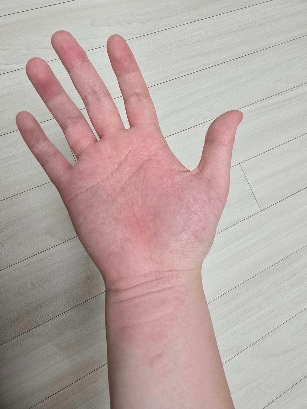 2번 째 사진