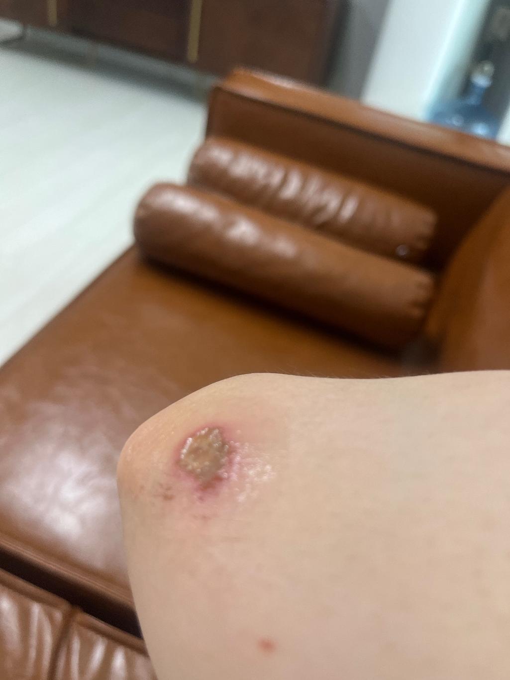 1번 째 사진