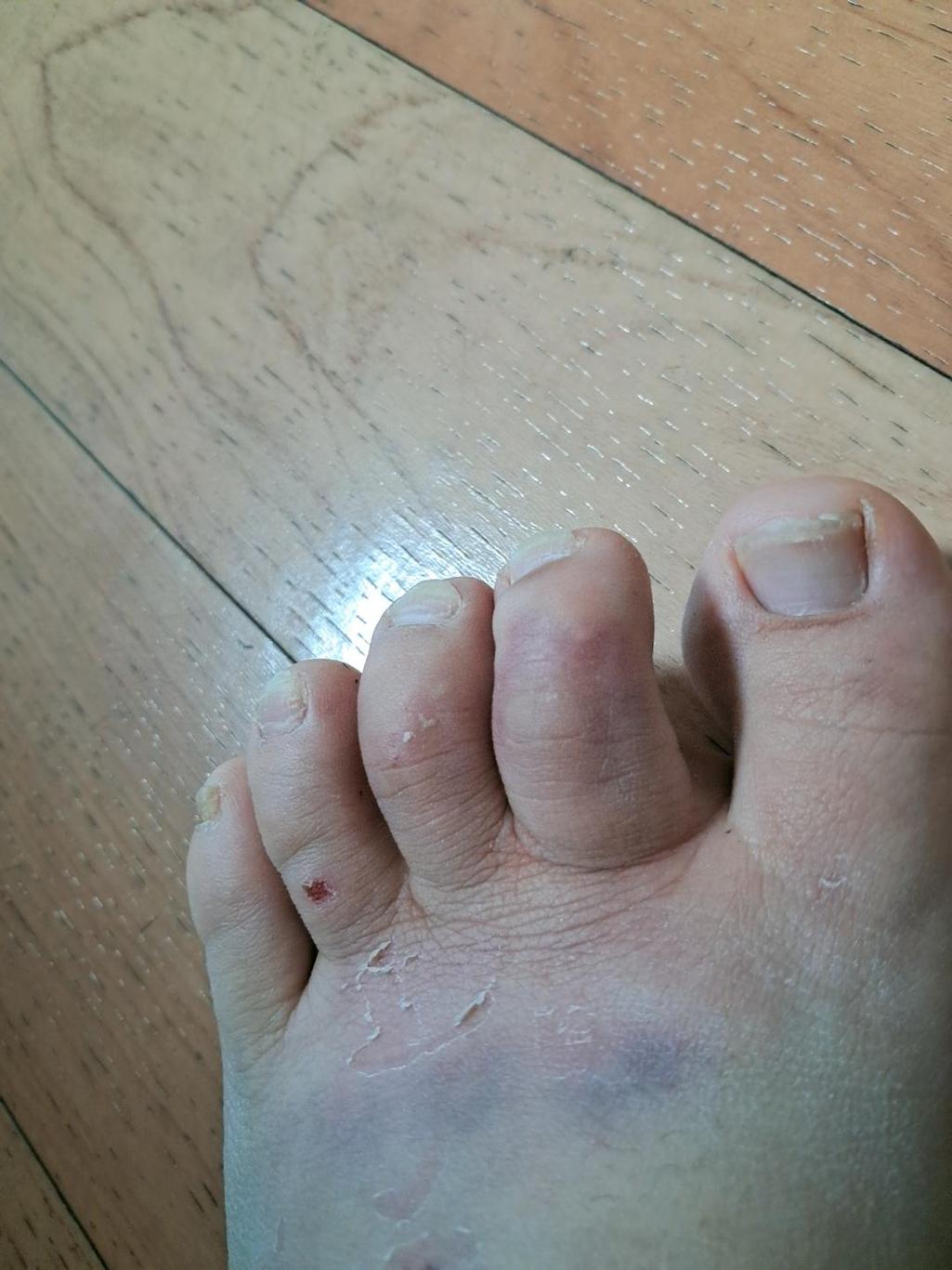 1번 째 사진