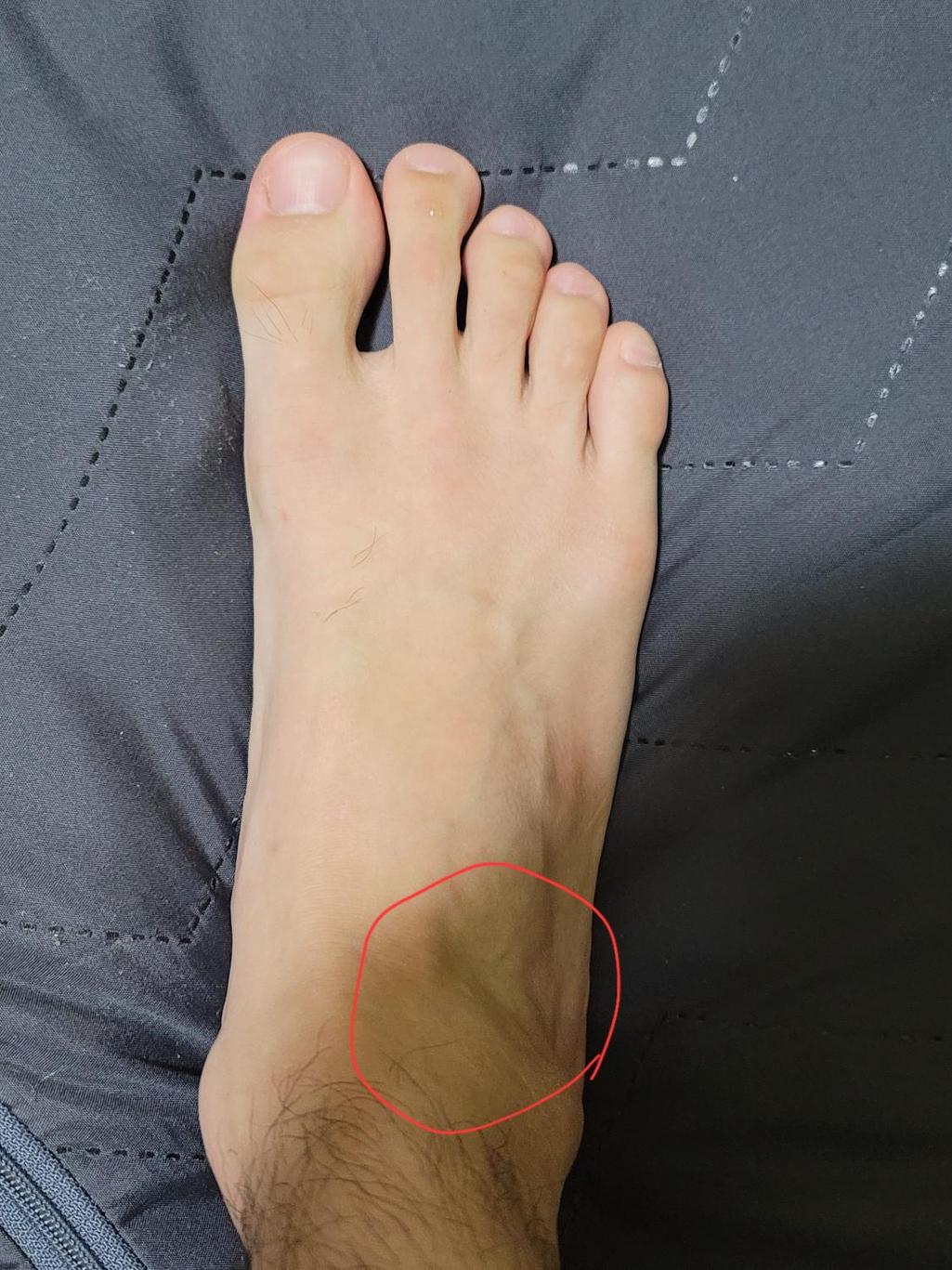2번 째 사진