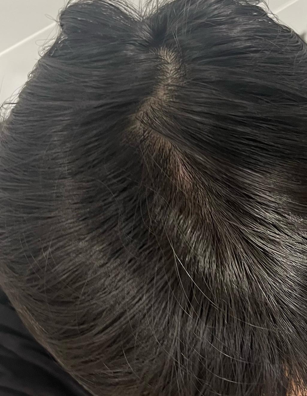 2번 째 사진