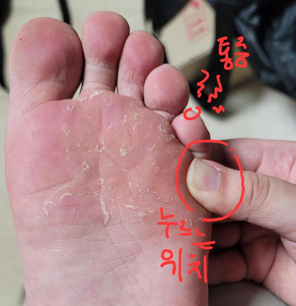 1번 째 사진