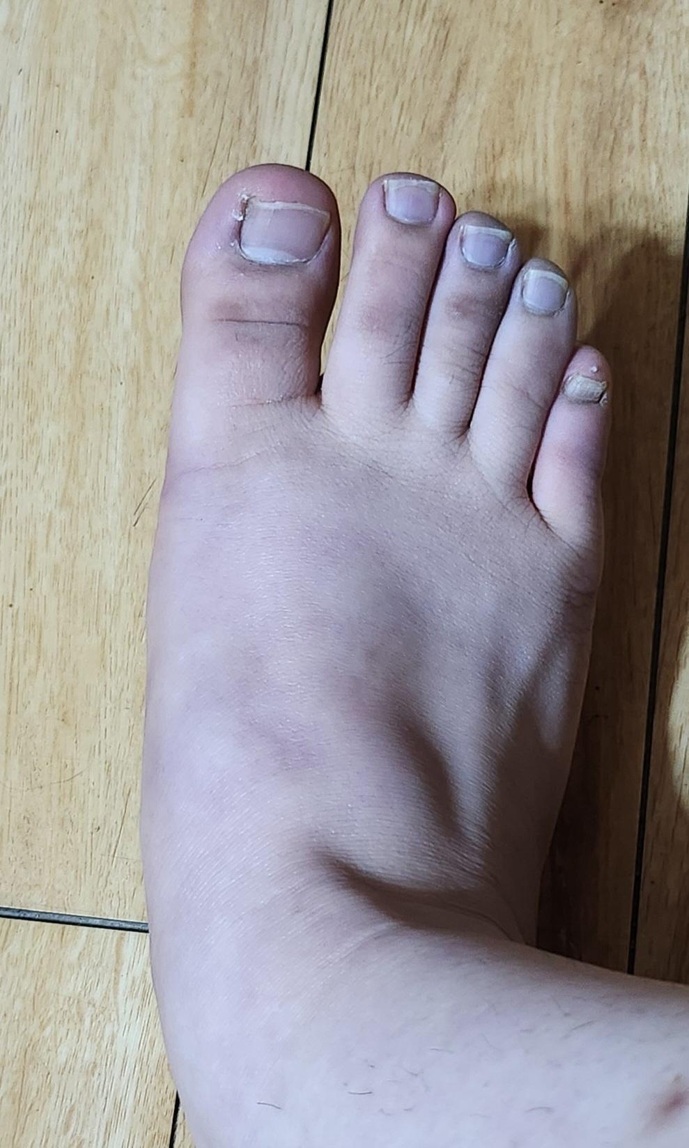 2번 째 사진
